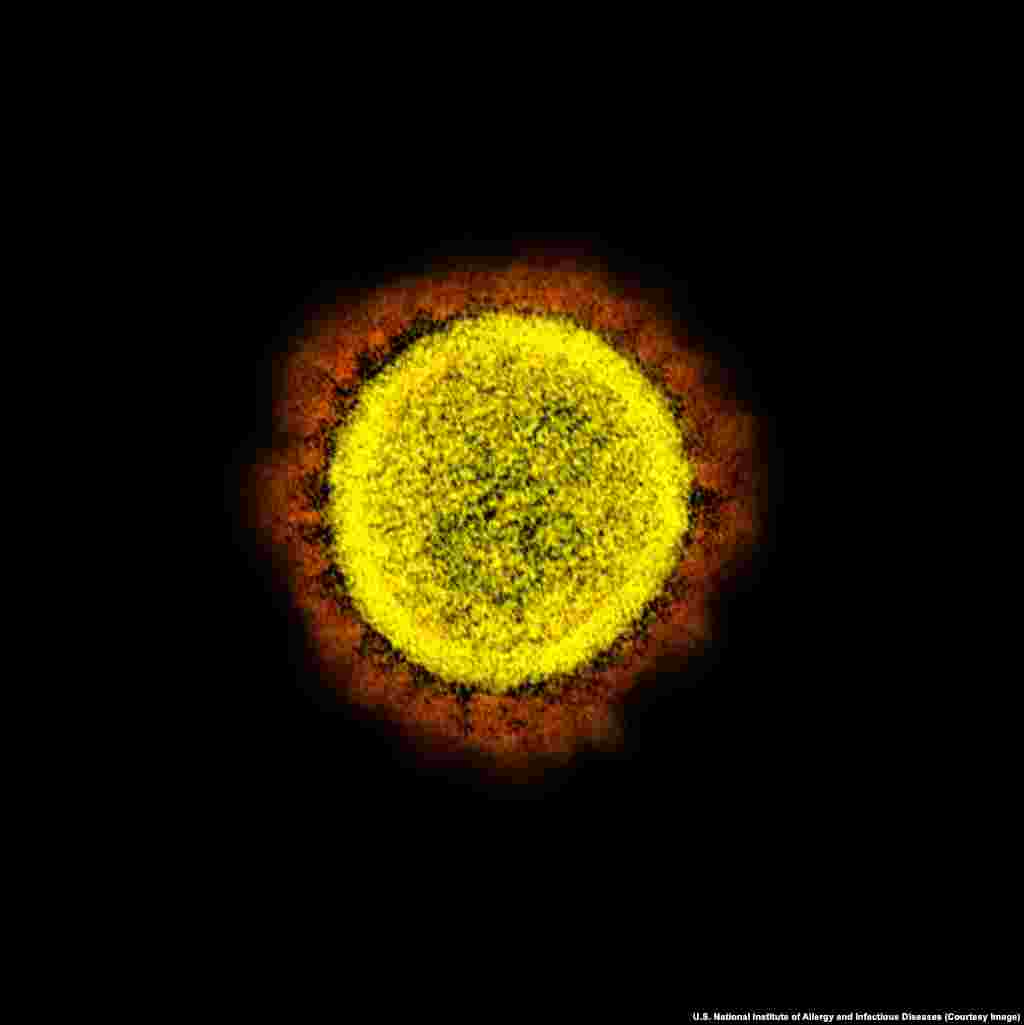 Вирион SARS-CoV-2. Под микроскопом вокруг вируса видны отростки, напоминающие солнечную корону, поэтому в его названии присутствует слово &quot;корона&quot;. В переводе с латинского &quot;корона&quot; означает ореол или венец.